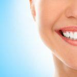 A woman is smiling while being at the dentist